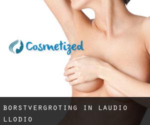 Borstvergroting in Laudio-Llodio