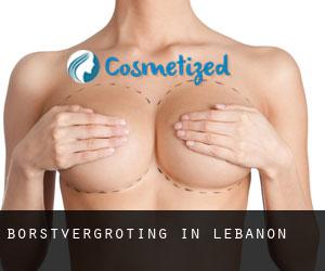 Borstvergroting in Lebanon