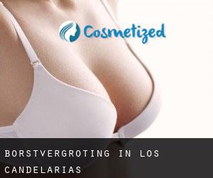 Borstvergroting in Los Candelarias