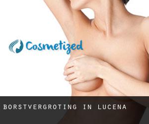 Borstvergroting in Lucena Borstvergroting in Lucena