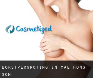Borstvergroting in Mae Hong Son