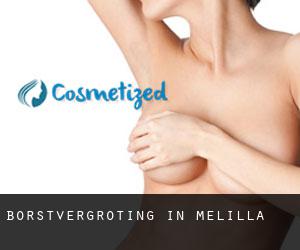 Borstvergroting in Melilla Borstvergroting in Melilla
