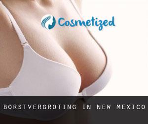 Borstvergroting in New Mexico Borstvergroting in New Mexico