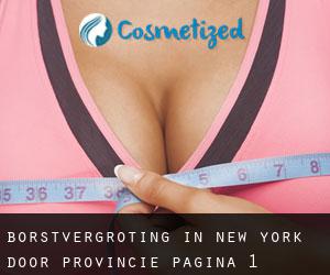 Borstvergroting in New York door Provincie - pagina 1