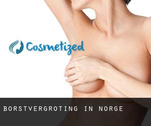 Borstvergroting in Norge
