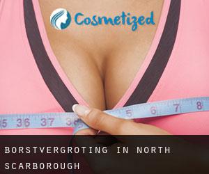 Borstvergroting in North Scarborough