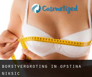 Borstvergroting in Opština Nikšić Borstvergroting in Opština Nikšić
