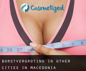 Borstvergroting in Other Cities in Macedonia