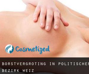 Borstvergroting in Politischer Bezirk Weiz