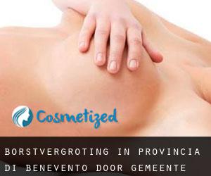 Borstvergroting in Provincia di Benevento door gemeente - pagina 2