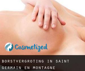 Borstvergroting in Saint-Germain-en-Montagne