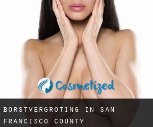 Borstvergroting in San Francisco County