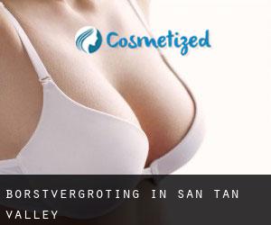 Borstvergroting in San Tan Valley