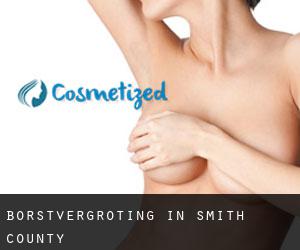 Borstvergroting in Smith County