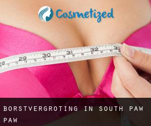 Borstvergroting in South Paw Paw
