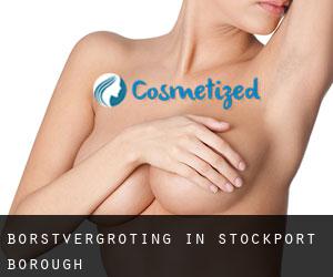 Borstvergroting in Stockport (Borough)