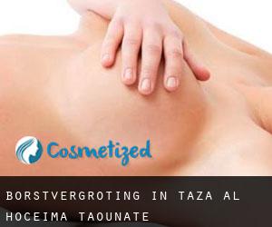 Borstvergroting in Taza-Al Hoceima-Taounate