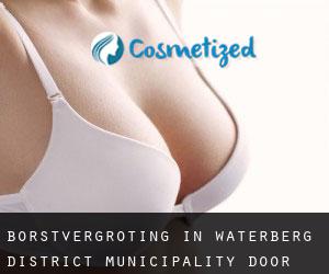 Borstvergroting in Waterberg District Municipality door plaats - pagina 1