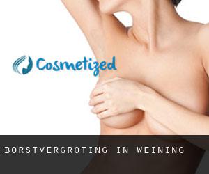 Borstvergroting in Weining Borstvergroting in Weining