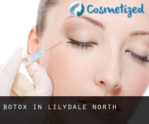 Botox in Lilydale North