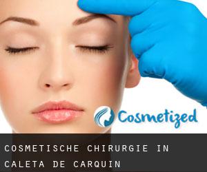 Cosmetische Chirurgie in Caleta de Carquín