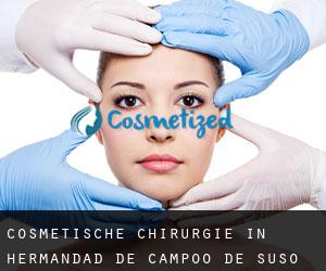 Cosmetische Chirurgie in Hermandad de Campoo de Suso