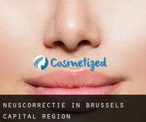 Neuscorrectie in Brussels Capital Region