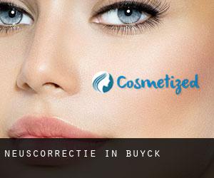 Neuscorrectie in Buyck