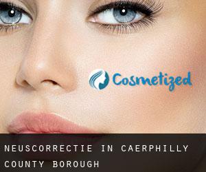 Neuscorrectie in Caerphilly (County Borough)