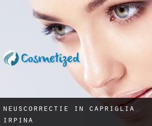 Neuscorrectie in Capriglia Irpina