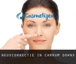 Neuscorrectie in Carrum Downs