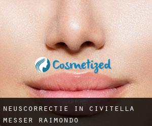 Neuscorrectie in Civitella Messer Raimondo