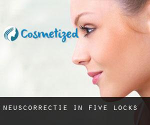 Neuscorrectie in Five Locks