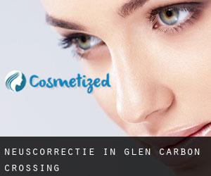 Neuscorrectie in Glen Carbon Crossing