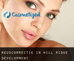 Neuscorrectie in Hill Ridge Development