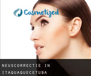 Neuscorrectie in Itaquaquecetuba