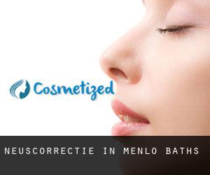 Neuscorrectie in Menlo Baths
