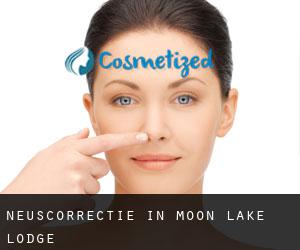 Neuscorrectie in Moon Lake Lodge