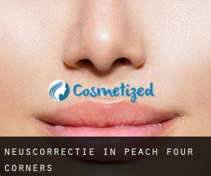 Neuscorrectie in Peach Four Corners