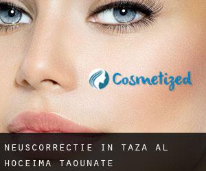 Neuscorrectie in Taza-Al Hoceima-Taounate