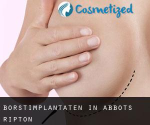 Borstimplantaten in Abbots Ripton