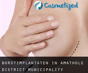 Borstimplantaten in Amathole District Municipality