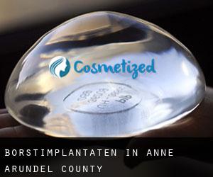 Borstimplantaten in Anne Arundel County