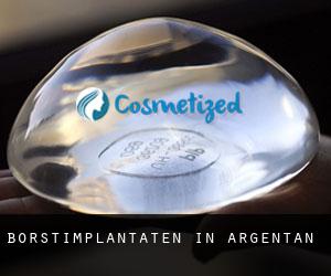 Borstimplantaten in Argentan