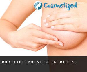 Borstimplantaten in Beccas