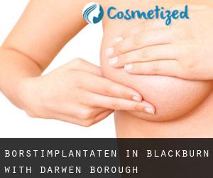 Borstimplantaten in Blackburn with Darwen (Borough)