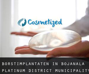 Borstimplantaten in Bojanala Platinum District Municipality