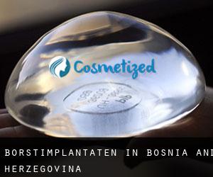 Borstimplantaten in Bosnia and Herzegovina