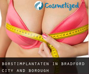 Borstimplantaten in Bradford (City and Borough)