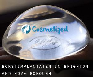 Borstimplantaten in Brighton and Hove (Borough)